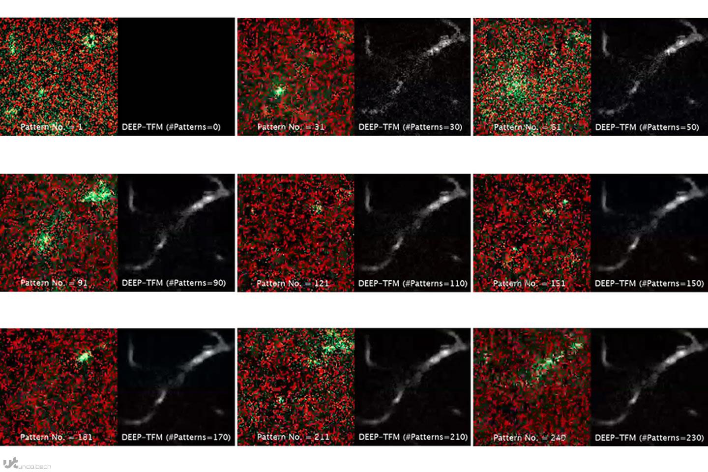 1625756393 temporal vs deep tfm image2 - روش میکروسکوپی MIT تصویربرداری از بافت های عمیق را بهبود می بخشد