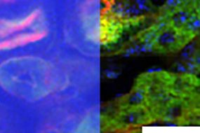 1625756468 temporal vs deep tfm image3 1280x720 1 285x190 - روش میکروسکوپی MIT تصویربرداری از بافت های عمیق را بهبود می بخشد