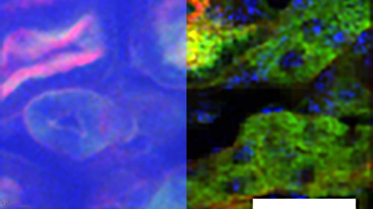 1625756468 temporal vs deep tfm image3 1280x720 1 - روش میکروسکوپی MIT تصویربرداری از بافت های عمیق را بهبود می بخشد