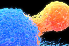 سلول های سرطانی