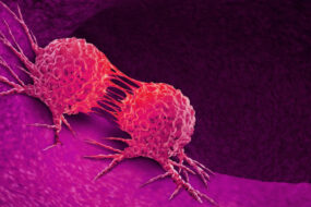 cancer 285x190 - اضافه وزن خطر ابتلا به سرطان رحم در زنان را تقریبا دو برابر می کند