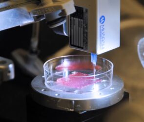 چاپ زیستی سه بعدی، آینده پیوند عضو